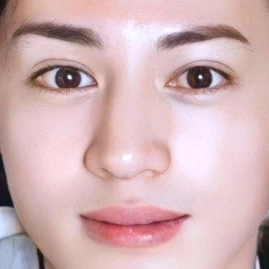 小麦アレルギー🌾 Tiktok ads