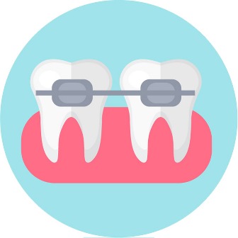 Dental Braces 4 Teens