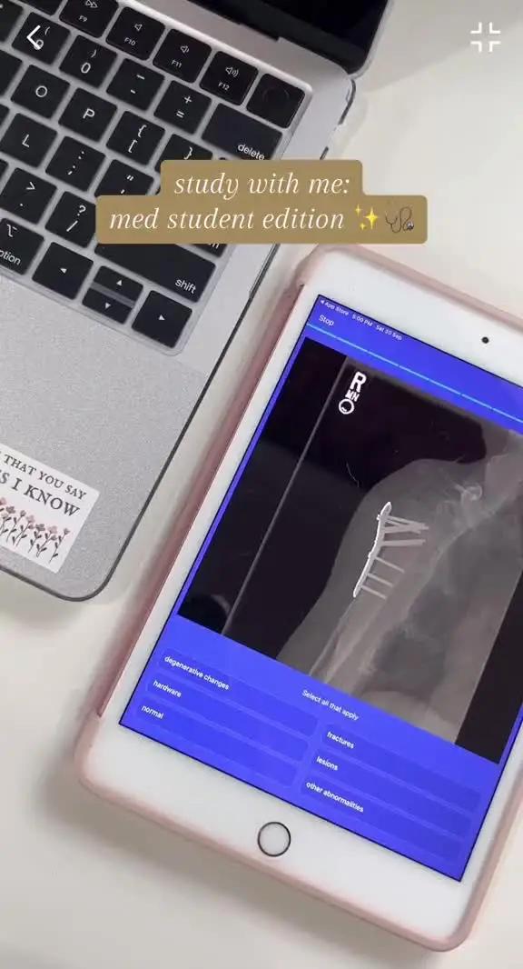 #medicaltiktok #doctor  #diagnosus  #premed  #learnontiktok  #medicalschool  #medicalstudent