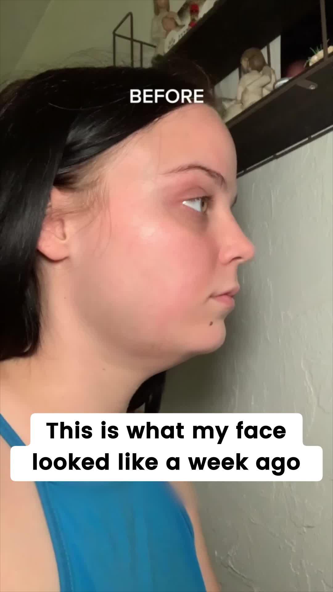 Solve your facial problems with Face Yoga！Try it for free now！