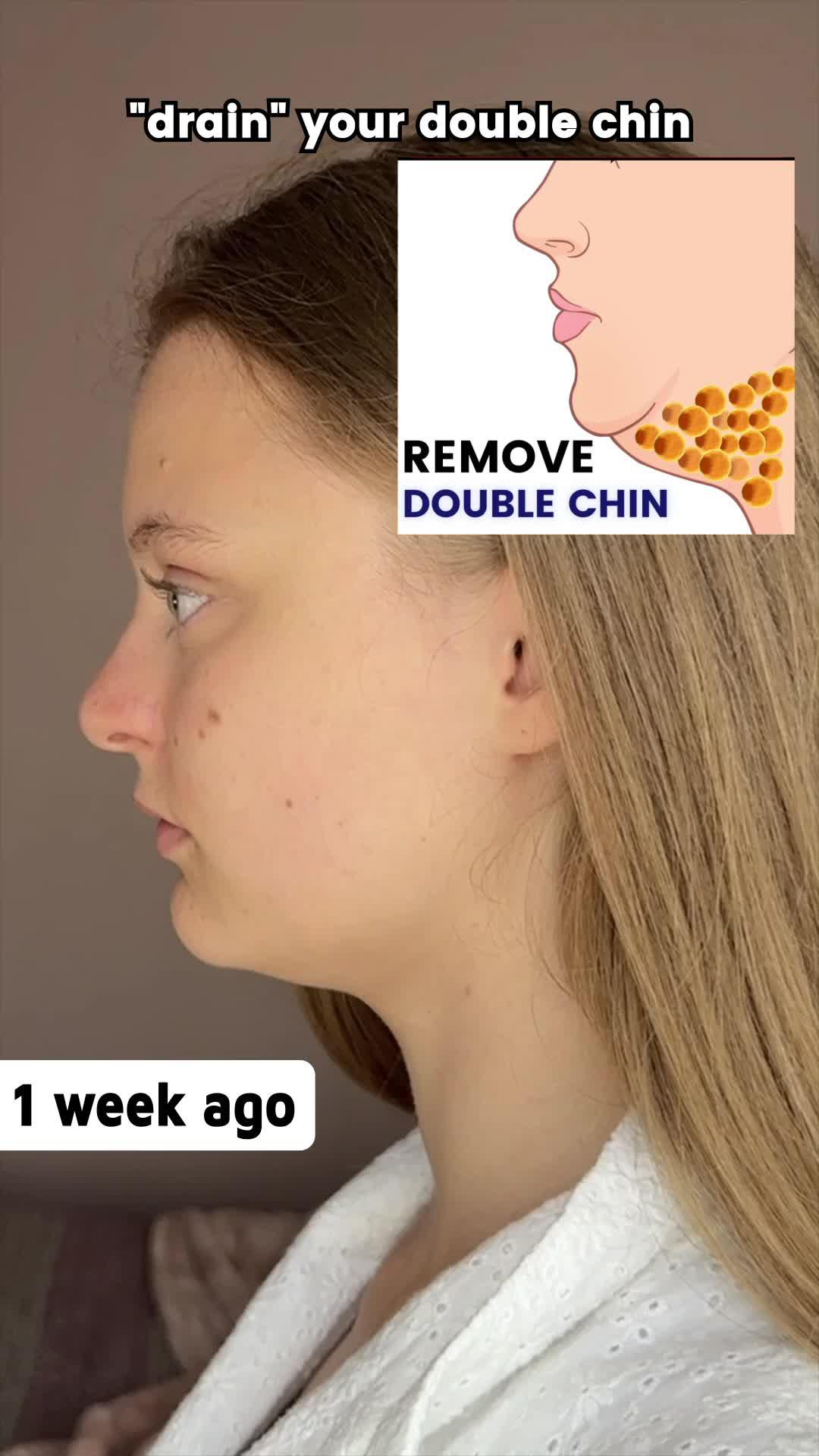 Follow FaceYogi's Customized Solutions for Facial Problems