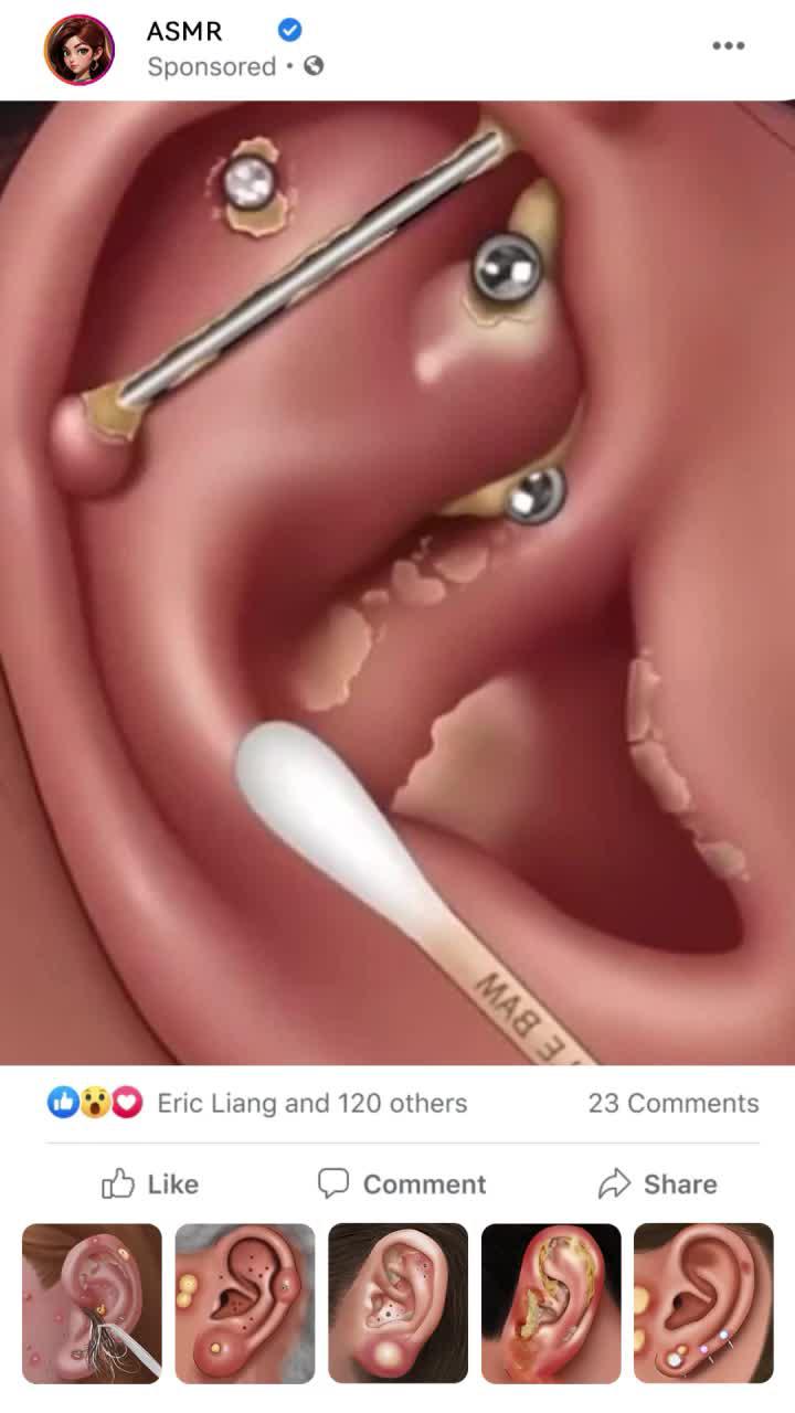 Be gentle! The wound hurts!