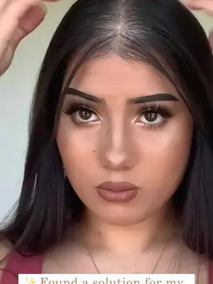 Found a solution for hair loss- Wearing a  hair topper! #hairtopper #thinninghair #uniwigstopper #alternativehair #hairloss