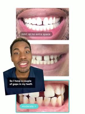 Now, we can show you your straighter teeth in minutes. Download the free app to get started.