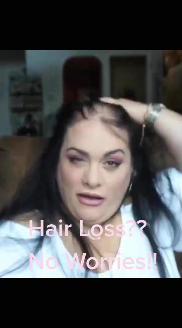 We help women All over the world that experience Hairloss! Shop link in the bio!#hairloss #thinninghair #hairtopper #hairtransform #alopeciaareata #hairtoppers