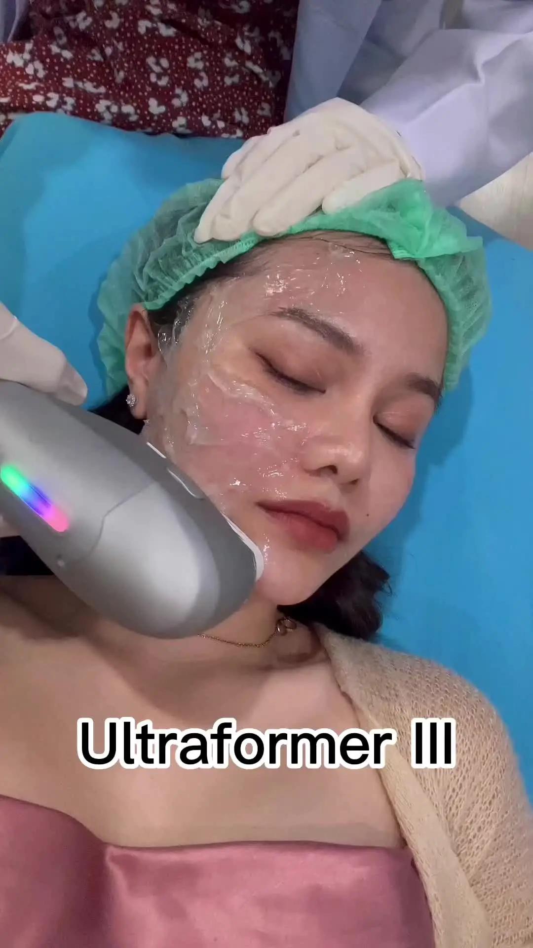 รีวิว Ultraformer III หน้าเรียวไม่เพิ่งเข็ม! มีโค้ดส่วนลด 20% ที่ SKINX ใส่ SXAMGAP #ultraformeriii #หน้าเรียวได้ไม่ฉีด #