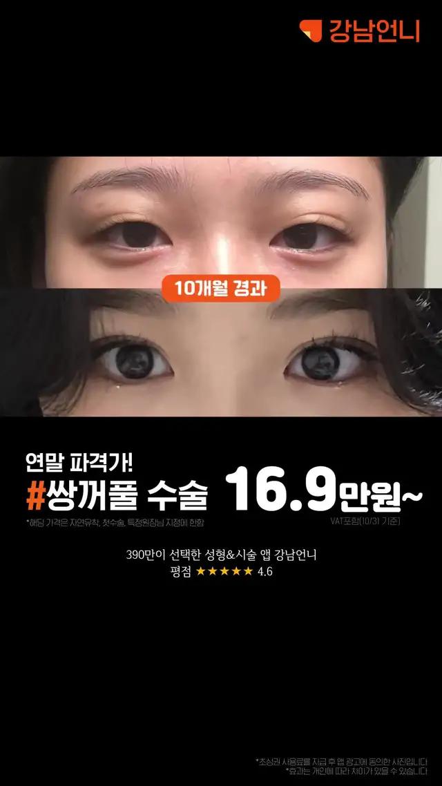 와 내가 찾던 후기 여기 다 있네ㄷㄷ