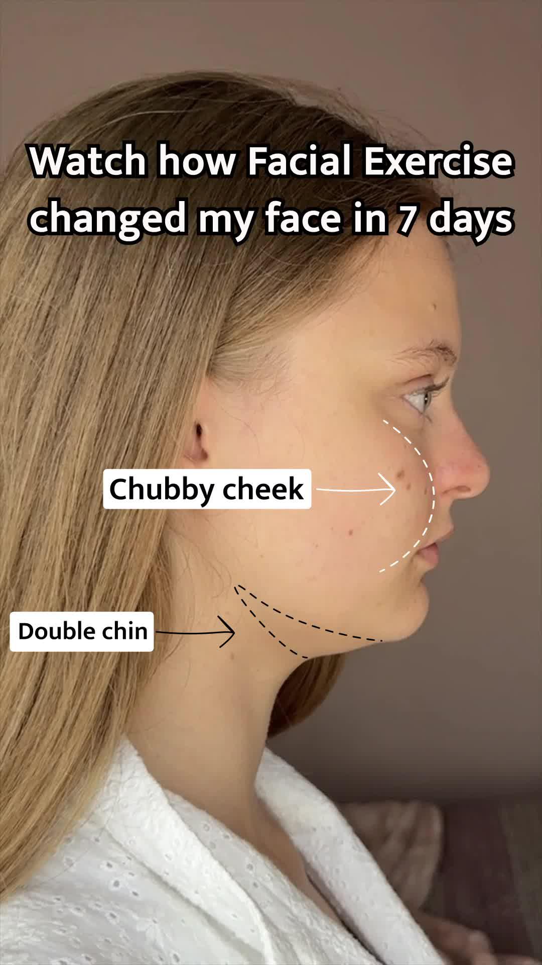 Follow FaceYogi's Customized Solutions for Facial Problems