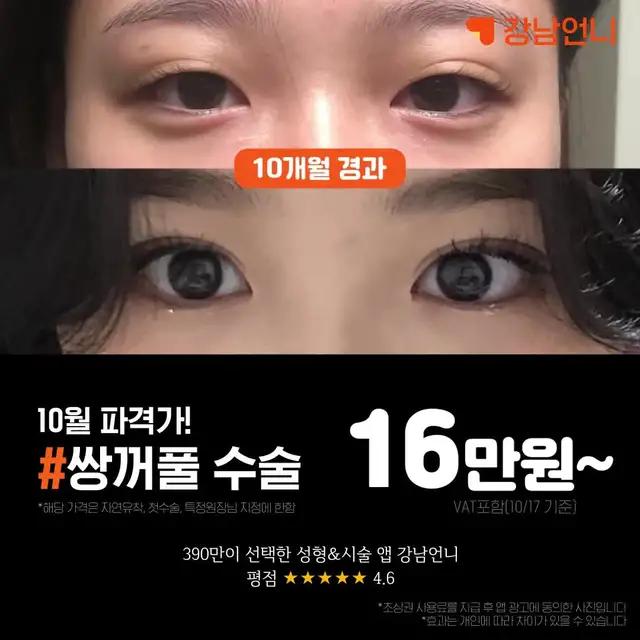 와 쌍수 진짜 잘됐다ㄷㄷ