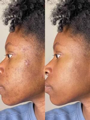 Simple, Easy and Natural photo editing!