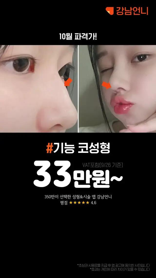 이벤트가 확인하고 할인가로 수술받자