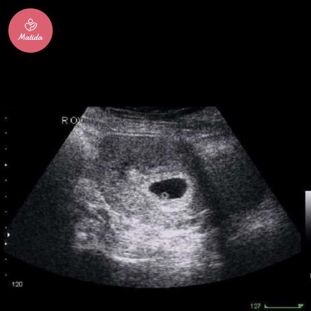 Khám phá Matida, trọn bộ kiến thức thai kỳ giúp mẹ bầu thông thái - con thông minh