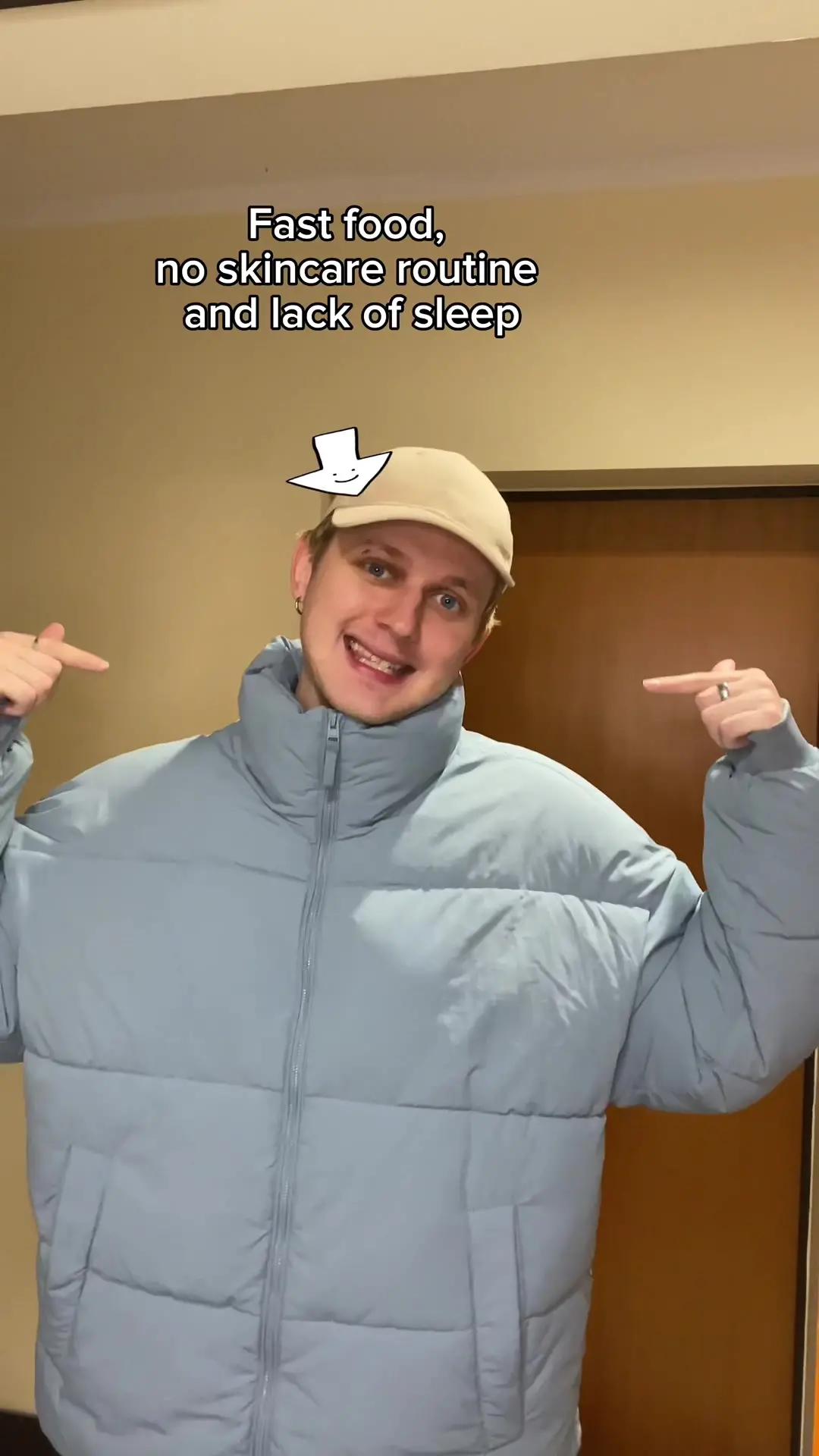 System Akvile knows everything about your pimples and habits 👀 