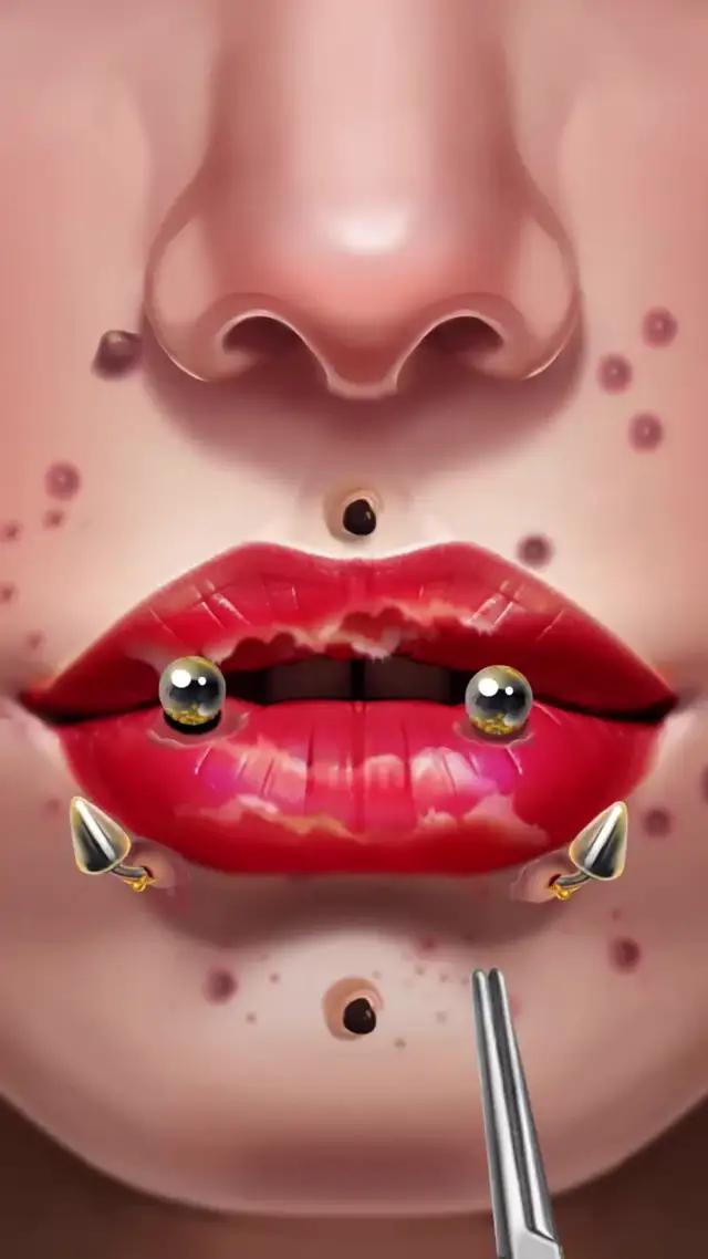 Be gentle! The wound hurts!