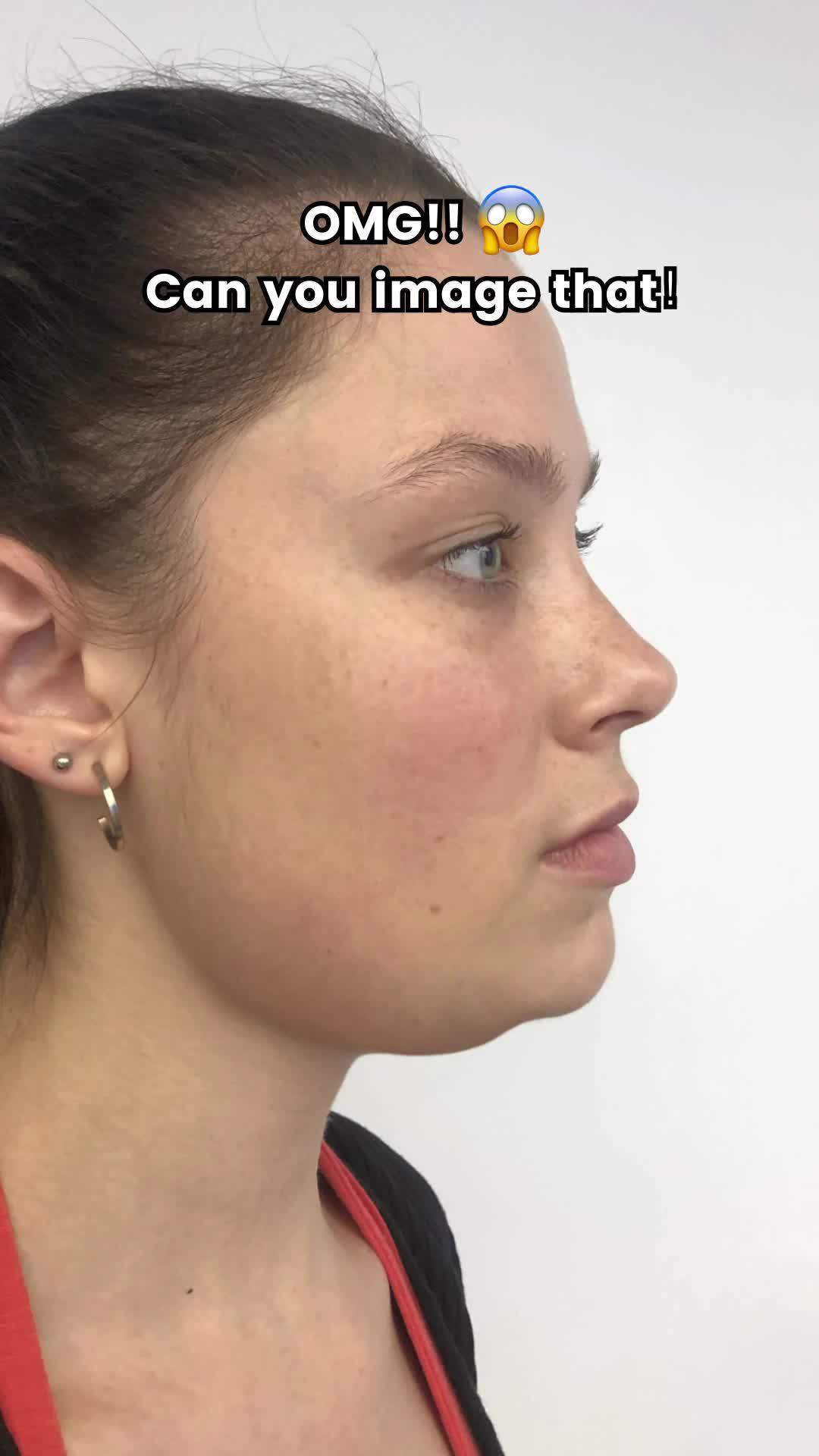 Solve your facial problems with face yoga！Try it for free now！