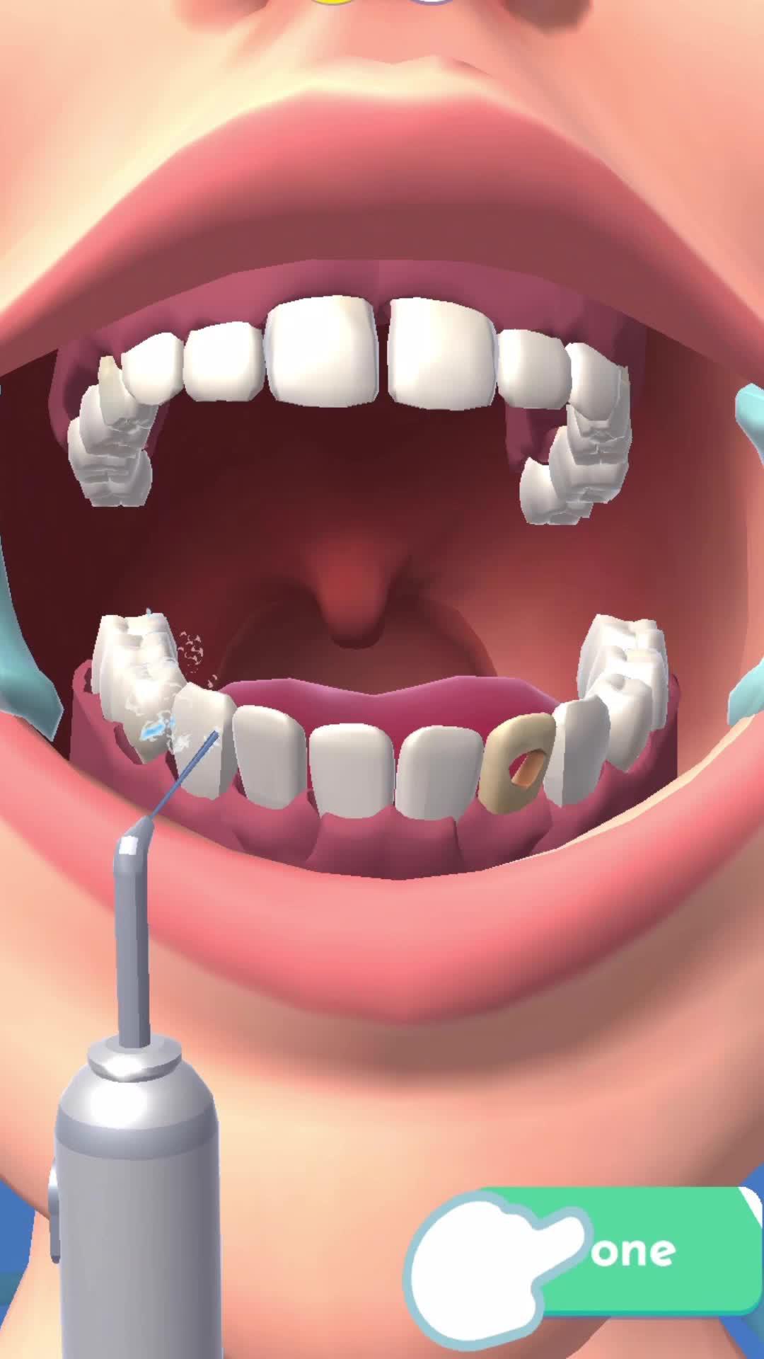 Teeth cleaning, bling, braces, we have it all in Perfect Smile!