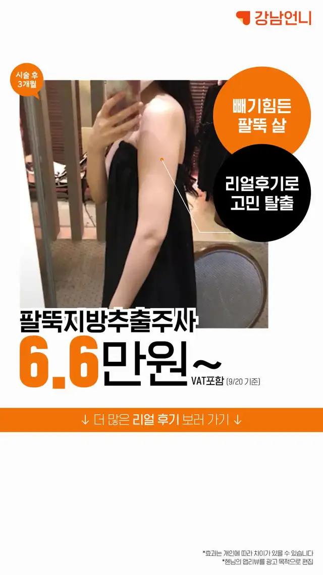 이벤트가 확인하고 할인가로 수술받자