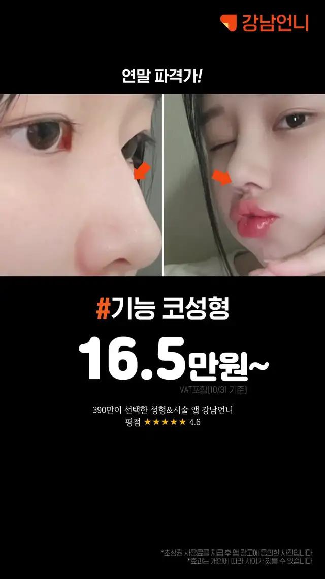 와 내가 찾던 후기 여기 다 있네ㄷㄷ