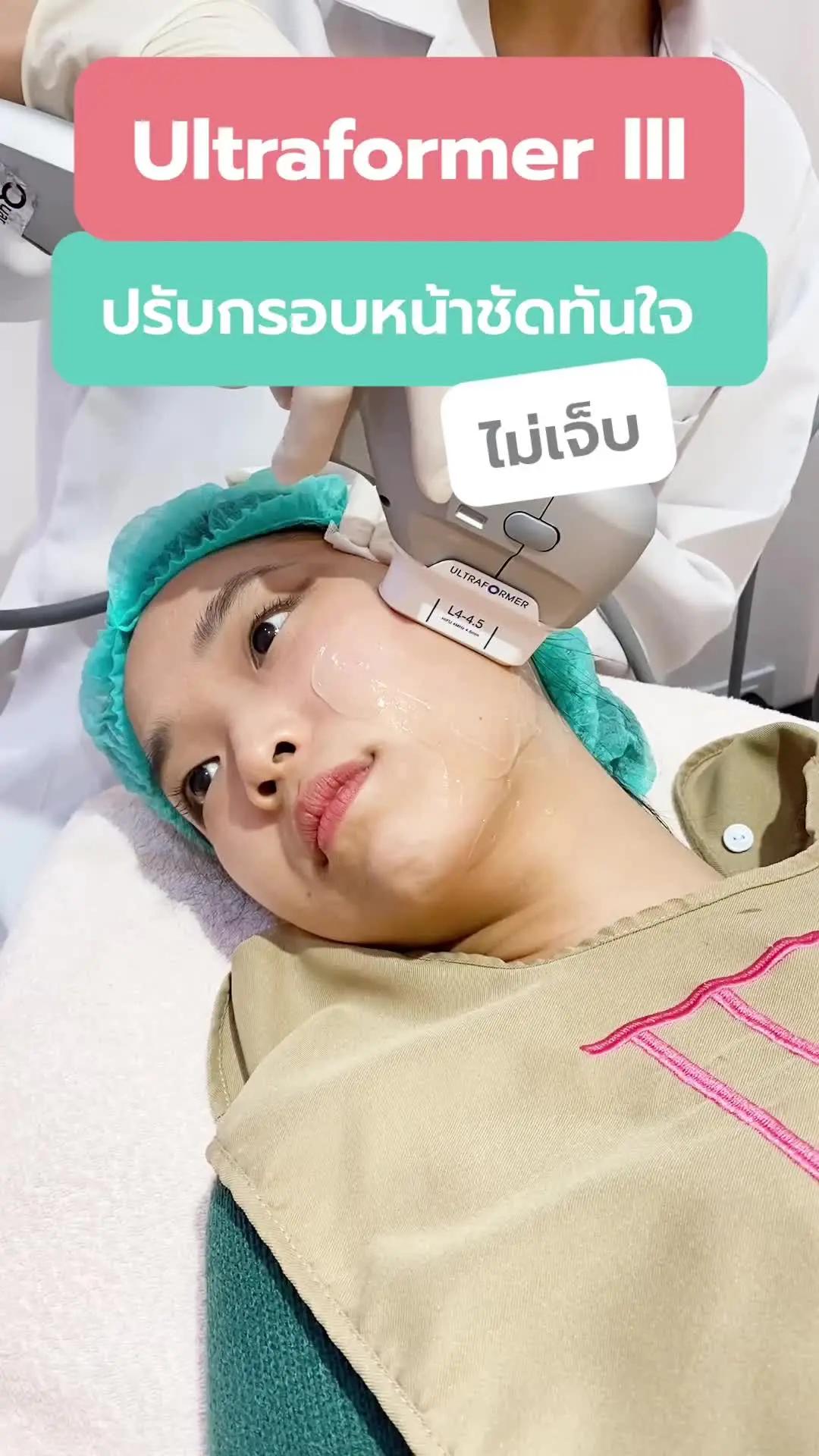 #รีวิว #UltraFormerIII  #ยกกระชับ ผิวหน้าเป๊ะไม่ต้องผ่าตัด✨ ช้อปดีลราคาดีต้องที่ #SkinXapp